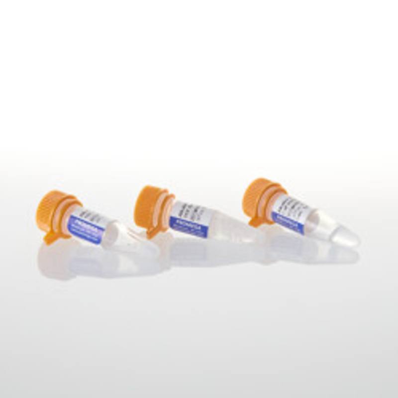 Alkaline Phosphatase Calf Intestinal, 1,000u