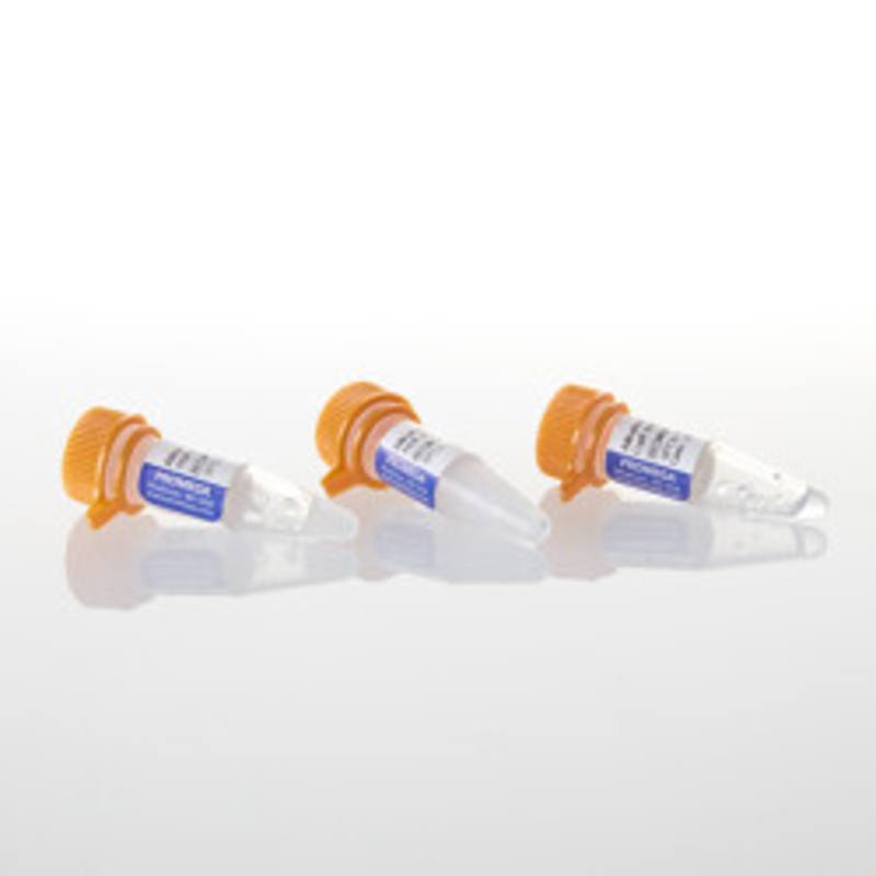 Alkaline Phosphatase Calf Intestinal (HC), 1,000u