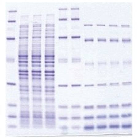 Scie-Plas Electrophoresis